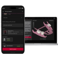 SprintRay NanoPrint - Connected software and print monitoring