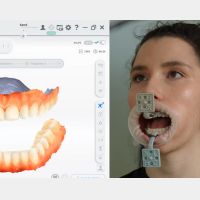 MetiSmile-MR trackers and markers