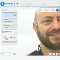MetiSmile automatic alignment