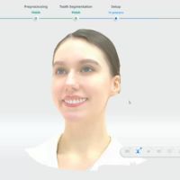 MetiSmile facial analysis and ortho simulation